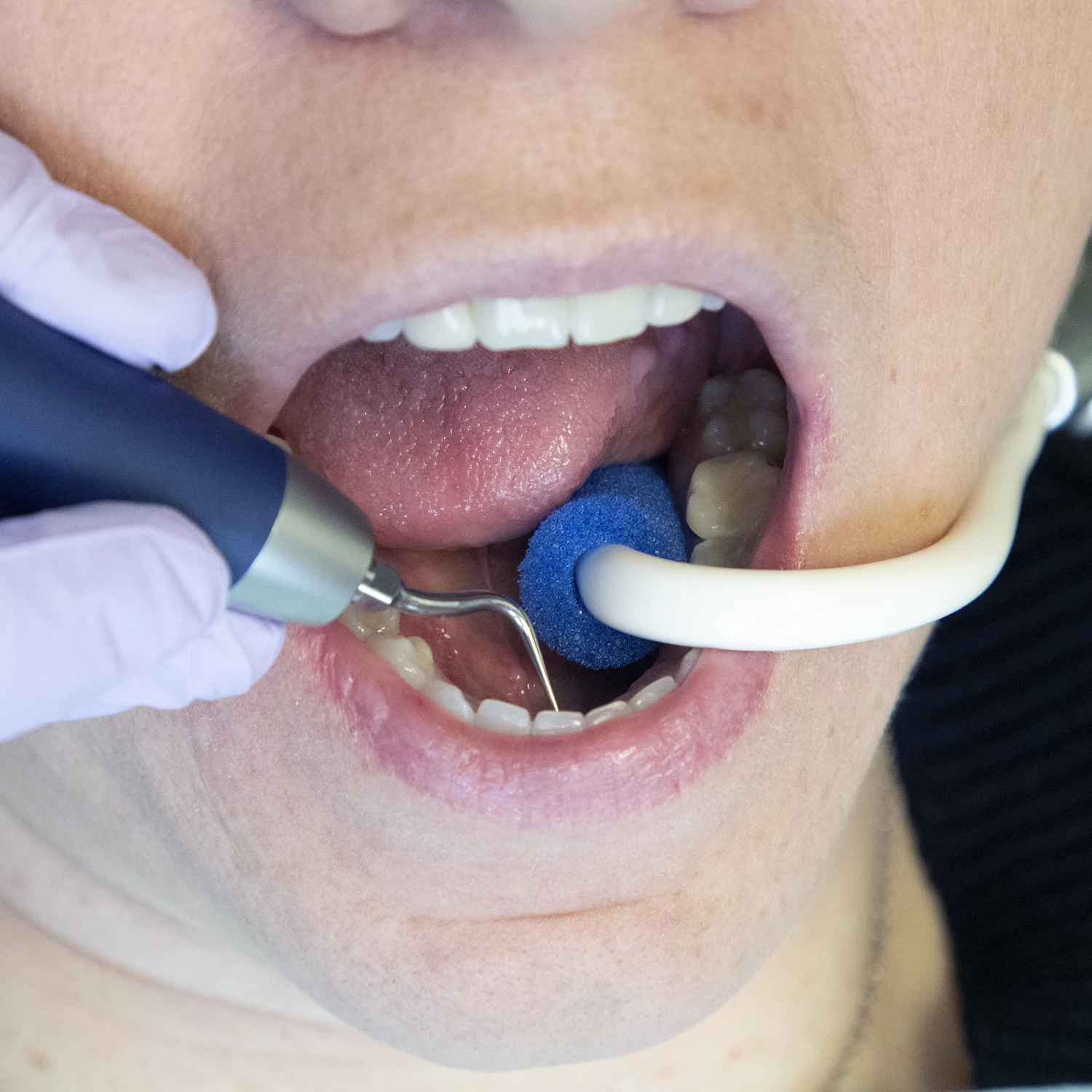 Мягкая насадка на слюноотсос SE-Cushion — изображение 2